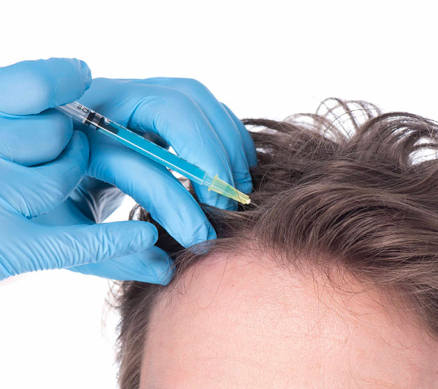 Hair Loss Treatment in Peerzadiguda