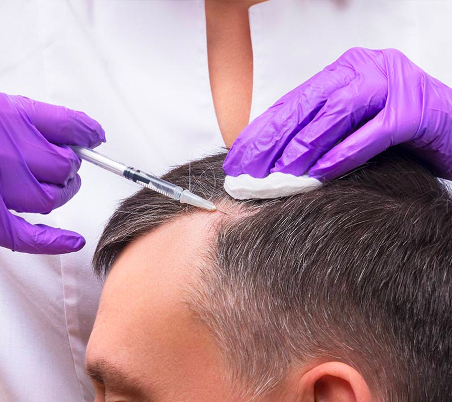 Hair Loss Treatment in Peerzadiguda